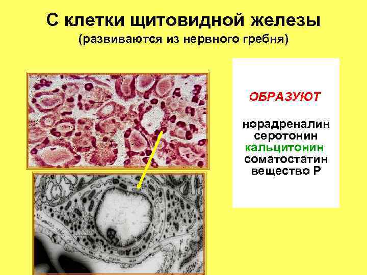 С клетки щитовидной железы (развиваются из нервного гребня) ОБРАЗУЮТ норадреналин серотонин кальцитонин соматостатин вещество