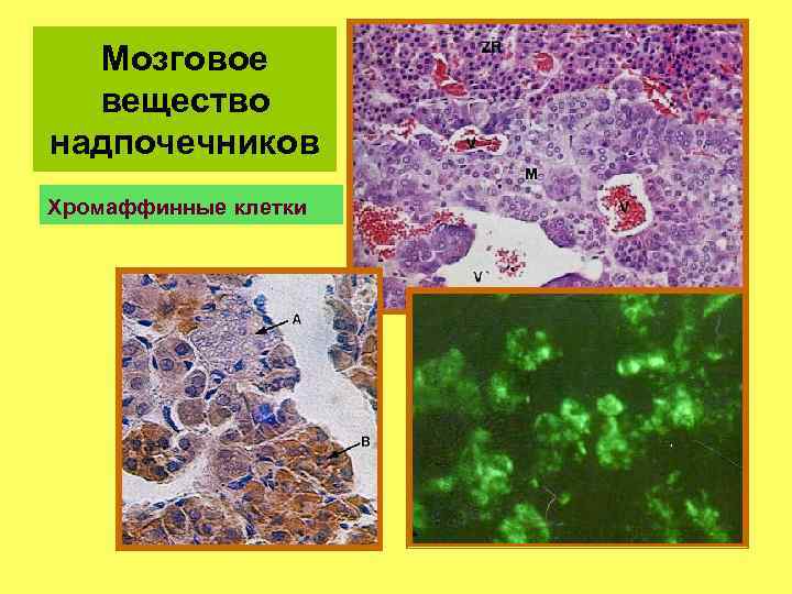 Мозговое вещество надпочечников презентация