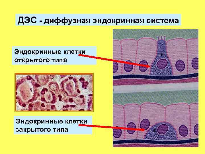 ДЭС - диффузная эндокринная система Эндокринные клетки -открытого типа Эндокринные клетки закрытого типа 