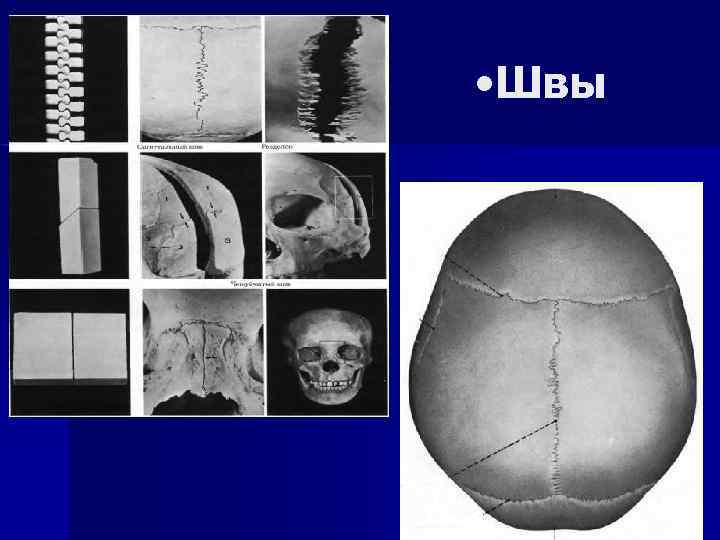  • Швы 