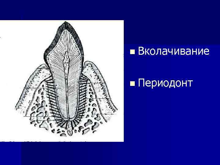 n Вколачивание n Периодонт 