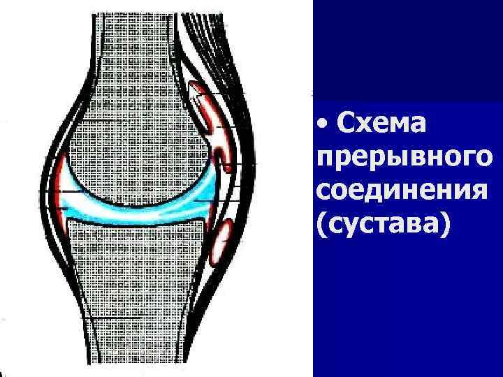  • Схема прерывного соединения (сустава) 