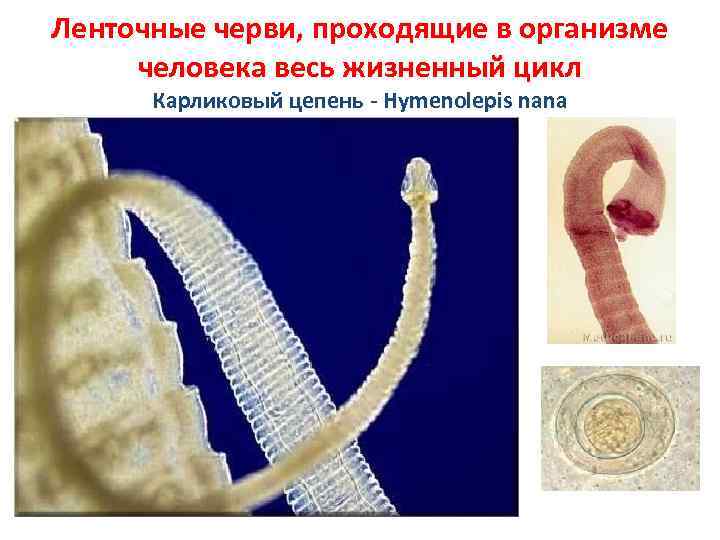 Жизнь ленточного червя. Ленточные черви (цестоды). Ленточные черви паразиты карликовый цепень. Цепень карликовый цепень карликовый.