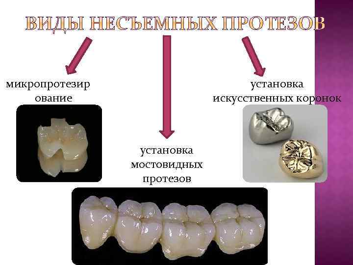 микропротезир ование установка искусственных коронок установка мостовидных протезов 