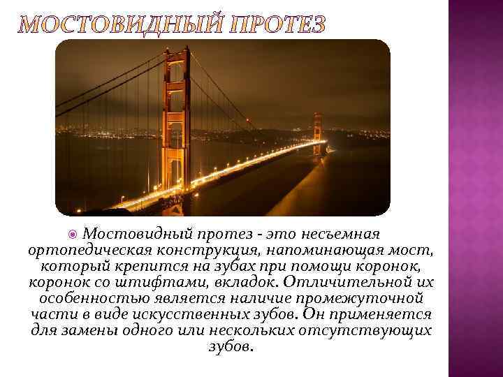 Мостовидный протез - это несъемная ортопедическая конструкция, напоминающая мост, который крепится на зубах при