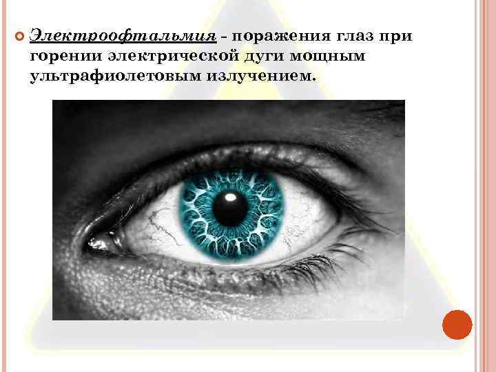  Электроофтальмия - поражения глаз при горении электрической дуги мощным ультрафиолетовым излучением. 