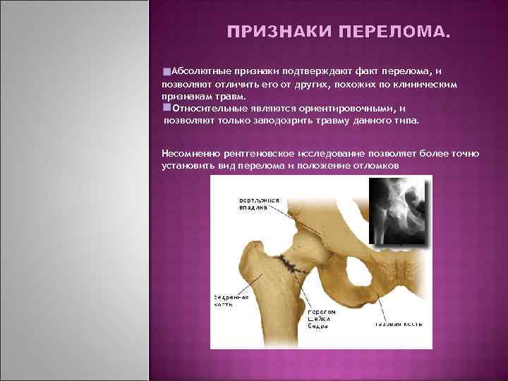 ПРИЗНАКИ ПЕРЕЛОМА. Абсолютные признаки подтверждают факт перелома, и позволяют отличить его от других, похожих