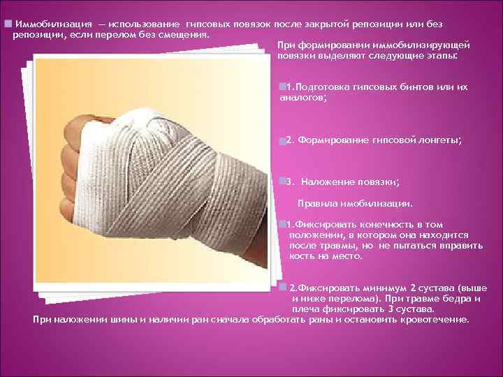 Иммобилизация — использование гипсовых повязок после закрытой репозиции или без репозиции, если перелом без