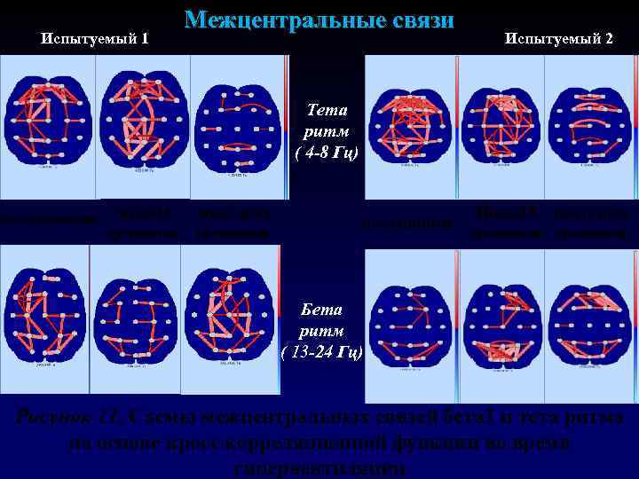 Испытуемый 1 Межцентральные связи Испытуемый 2 Тета ритм ( 4 -8 Гц) после 15