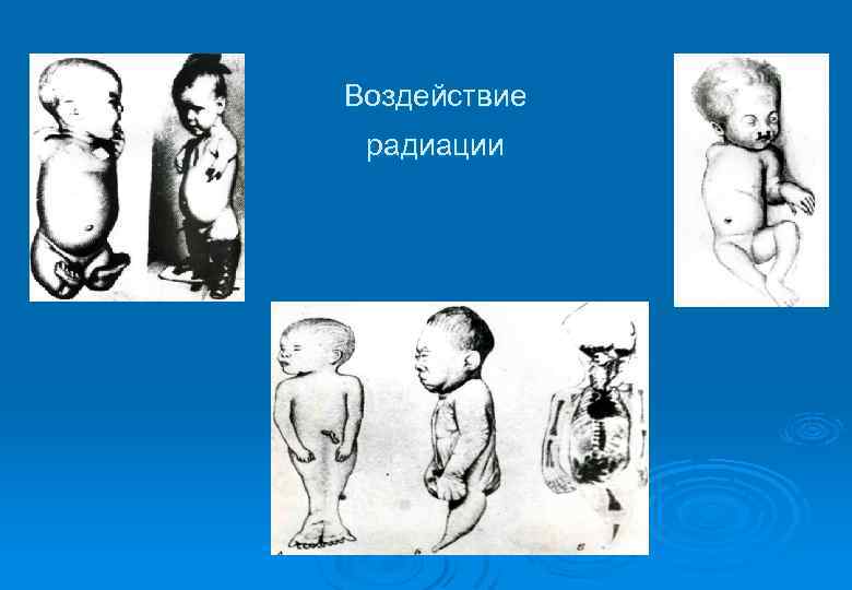 Воздействие радиации 