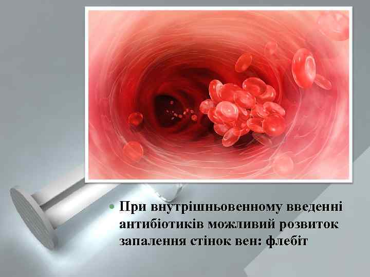  При внутрішньовенному введенні антибіотиків можливий розвиток запалення стінок вен: флебіт 