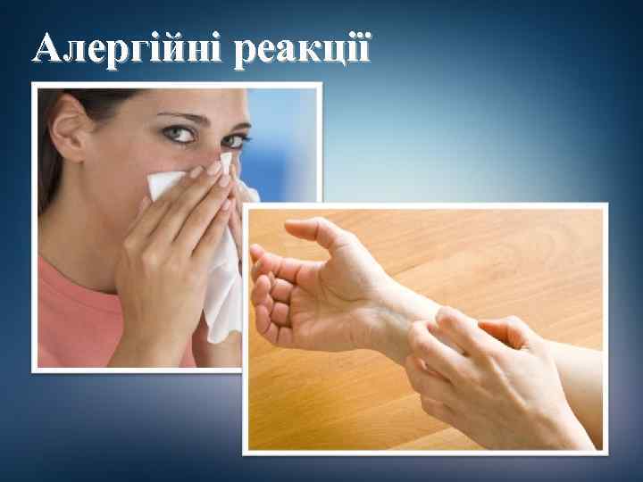 Алергійні реакції 