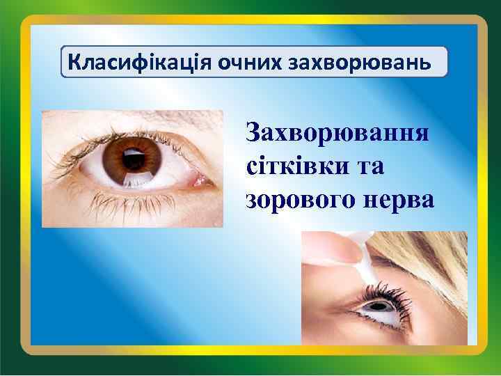 Класифікація очних захворювань Захворювання сітківки та зорового нерва 