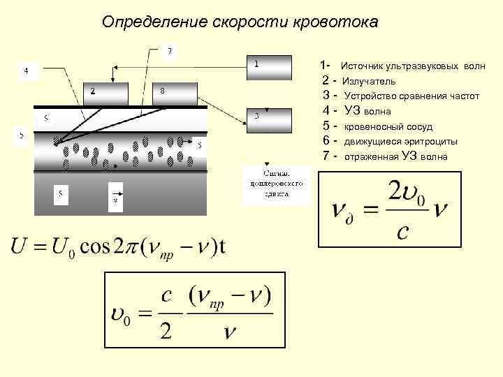Определение скорости кровотока 1 - Источник ультразвуковых волн 2 - Излучатель 3 - Устройство