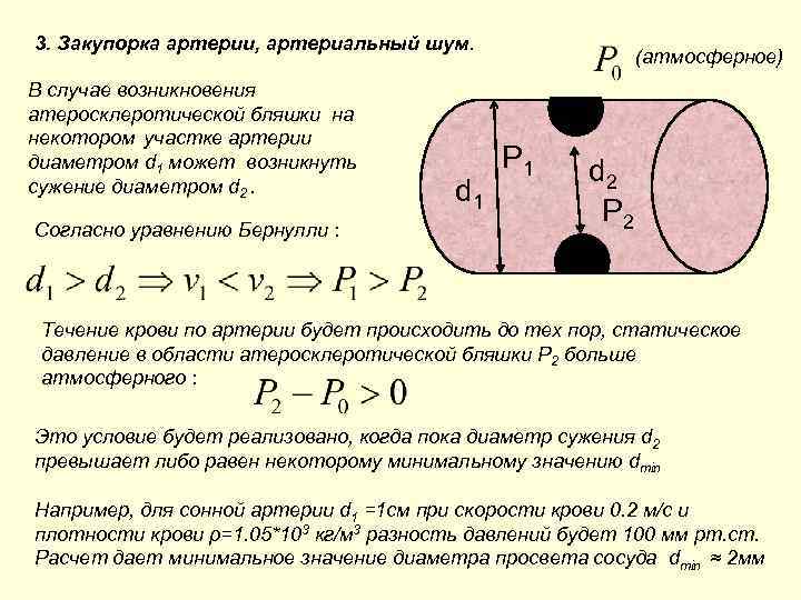 3. Закупорка артерии, артериальный шум. В случае возникновения атеросклеротической бляшки на некотором участке артерии