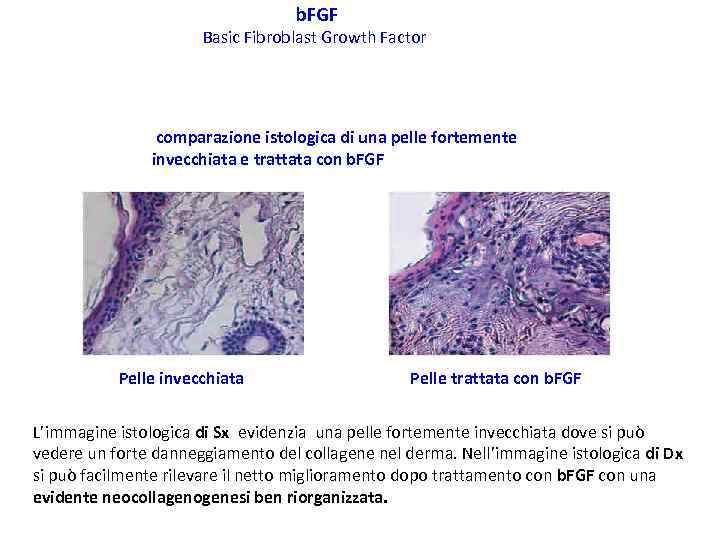 b. FGF Basic Fibroblast Growth Factor comparazione istologica di una pelle fortemente invecchiata e