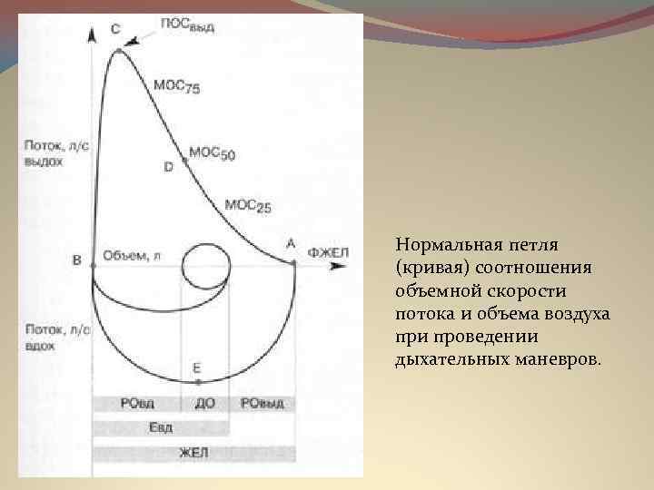 Нормальная петля (кривая) соотношения объемной скорости потока и объема воздуха при проведении дыхательных маневров.