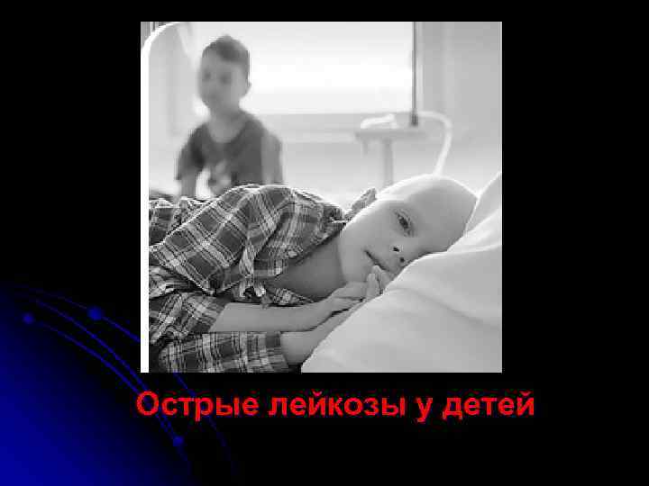 Острые лейкозы у детей 