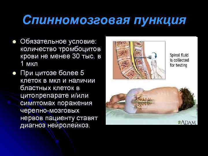Спинномозговая пункция l l Обязательное условие: количество тромбоцитов крови не менее 30 тыс. в