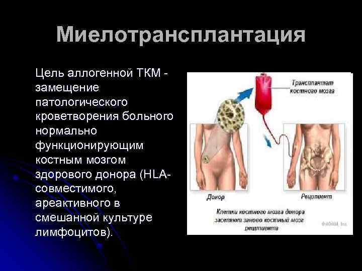 Миелотрансплантация Цель аллогенной ТКМ - замещение патологического кроветворения больного нормально функционирующим костным мозгом здорового