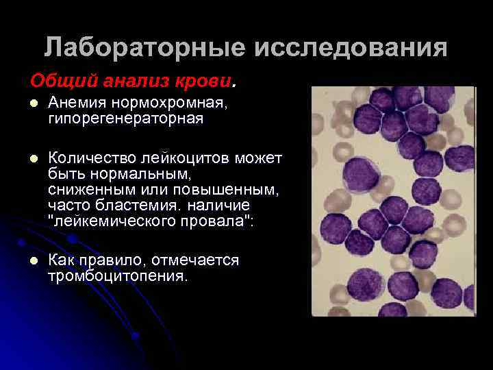 Лабораторные исследования Общий анализ крови. l Анемия нормохромная, гипорегенераторная l Количество лейкоцитов может быть