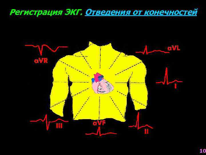 Регистрация ЭКГ. Отведения от конечностей 10 