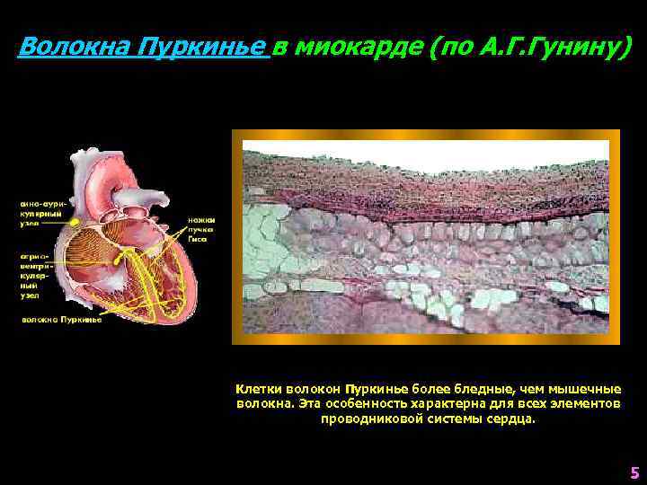 Волокна Пуркинье в миокарде (по А. Г. Гунину) Клетки волокон Пуркинье более бледные, чем