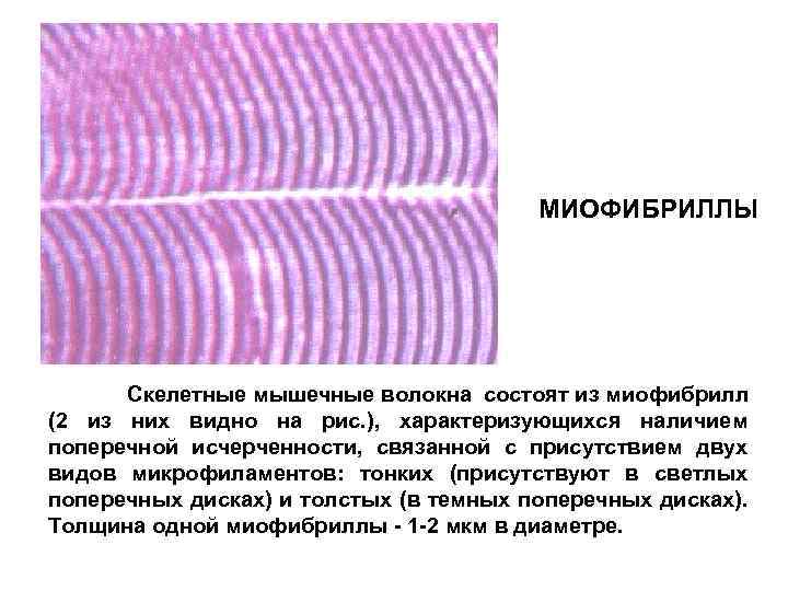 Схема саркомера миофибриллы мышечного волокна