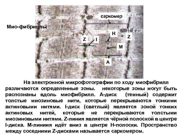 саркомер Мио-фибриллы H Z Z I M A На электронной микрофотографии по ходу миофибрилл