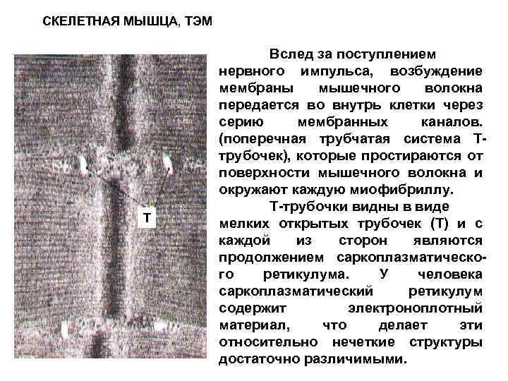 СКЕЛЕТНАЯ МЫШЦА, TЭM T Вслед за поступлением нервного импульса, возбуждение мембраны мышечного волокна передается