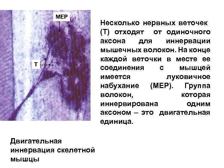 MEP T Двигательная иннервация скелетной мышцы Несколько нервных веточек (Т) отходят от одиночного аксона
