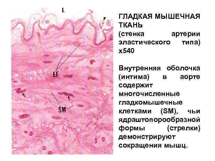 Ткани стенкам. Стенка артерии эластического типа. Эластический каркас артерий мышечного типа. Лекции по гистологии мышечные ткани. Стенка артерий эластического типа содержит.