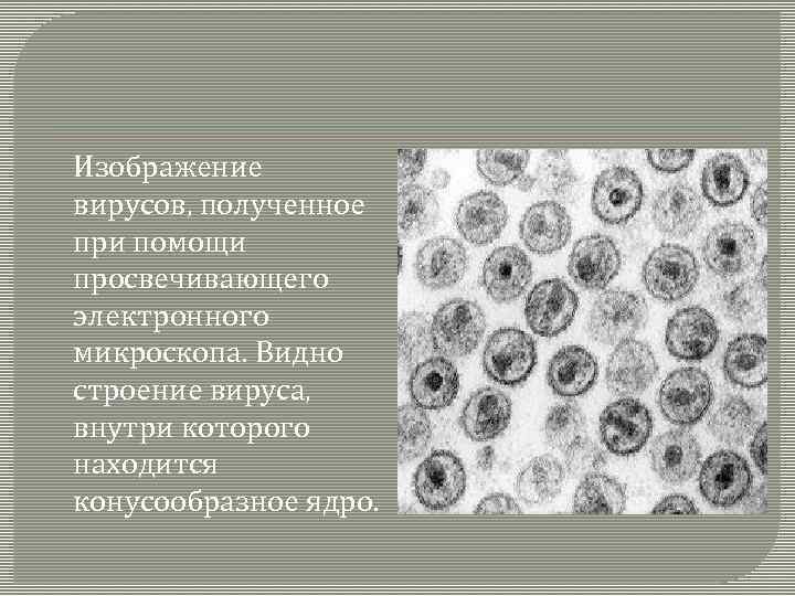 Изображение вирусов, полученное при помощи просвечивающего электронного микроскопа. Видно строение вируса, внутри которого находится