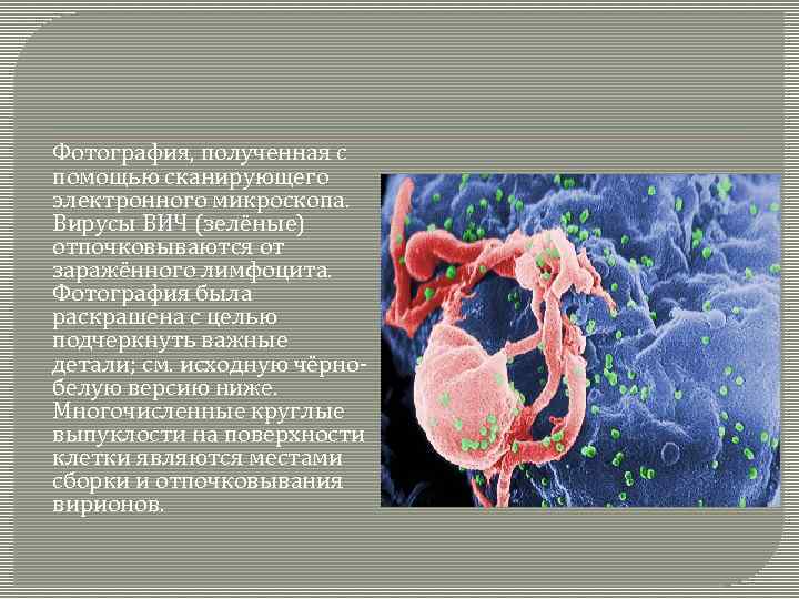 Фотография, полученная с помощью сканирующего электронного микроскопа. Вирусы ВИЧ (зелёные) отпочковываются от заражённого лимфоцита.
