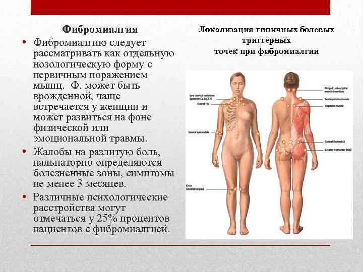 Фибромиалгия • Фибромиалгию следует рассматривать как отдельную нозологическую форму с первичным поражением мышц. Ф.