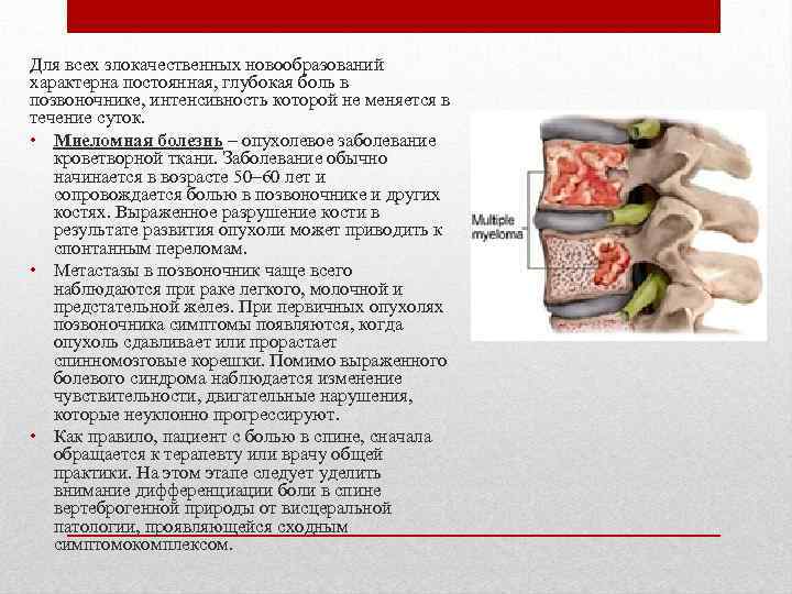 Для всех злокачественных новообразований характерна постоянная, глубокая боль в позвоночнике, интенсивность которой не меняется