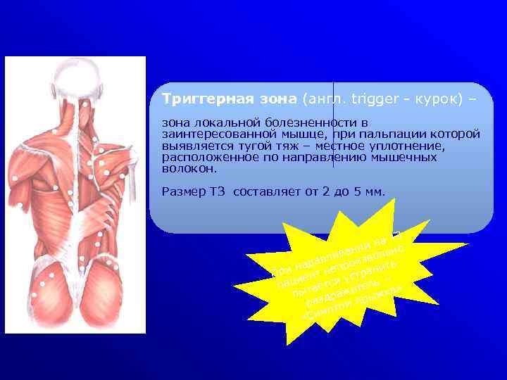 Триггерная зона (англ. trigger - курок) – зона локальной болезненности в заинтересованной мышце, при