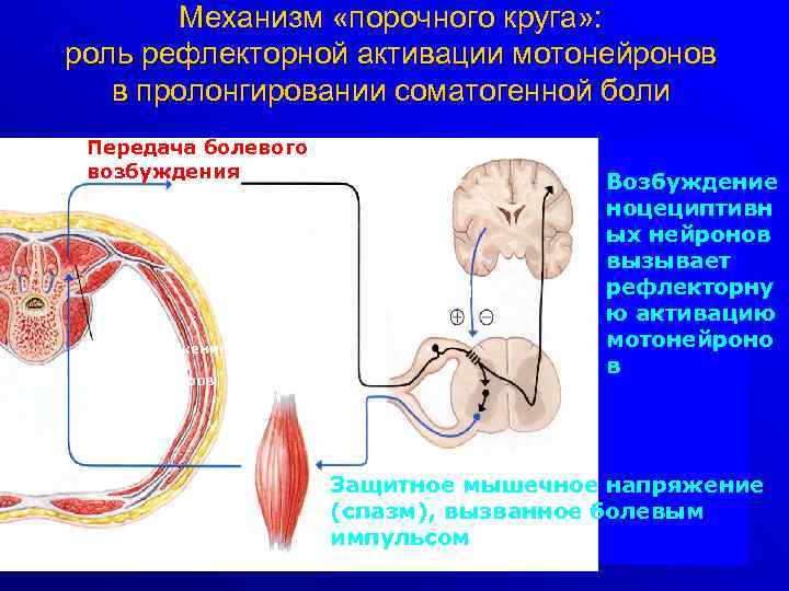 Механизм «порочного круга» : роль рефлекторной активации мотонейронов в пролонгировании соматогенной боли Передача болевого