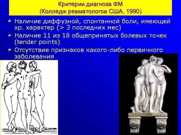 Критерии диагноза ФМ (Колледж ревматологов США, 1990) Наличие диффузной, спонтанной боли, имеющей хр. характер