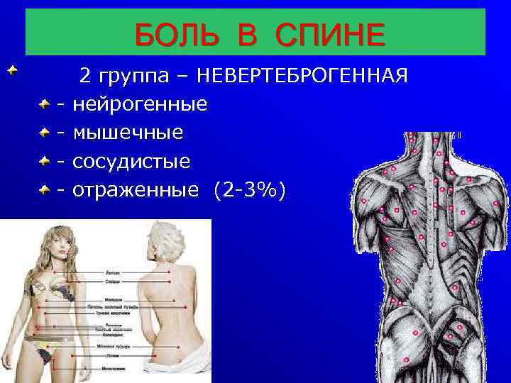 БОЛЬ В СПИНЕ - 2 группа – НЕВЕРТЕБРОГЕННАЯ нейрогенные мышечные сосудистые отраженные (2 -3%)