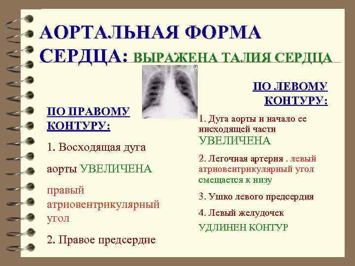 АОРТАЛЬНАЯ ФОРМА СЕРДЦА: ВЫРАЖЕНА ТАЛИЯ СЕРДЦА ПО ПРАВОМУ КОНТУРУ: 1. Восходящая дуга аорты УВЕЛИЧЕНА