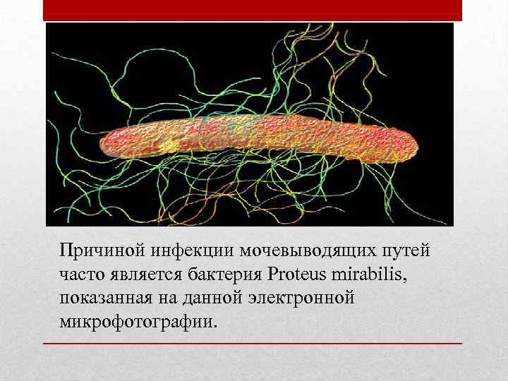 Причиной инфекции мочевыводящих путей часто является бактерия Proteus mirabilis, показанная на данной электронной микрофотографии.