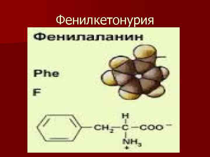 Фенилкетонурия 