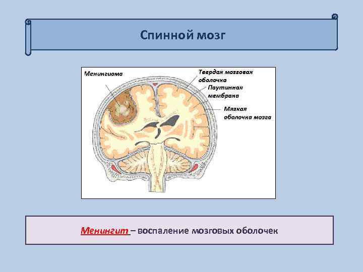 Спинной мозг Менингит – воспаление мозговых оболочек 