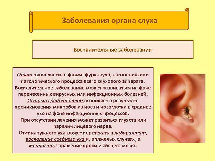 Заболевания органа слуха Воспалительные заболевания Отит проявляется в форме фурункула, нагноения, или патологического процесса