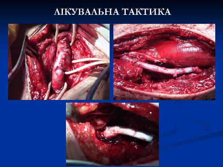 ЛІКУВАЛЬНА ТАКТИКА 