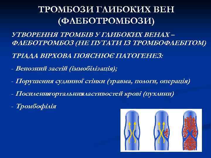 ТРОМБОЗИ ГЛИБОКИХ ВЕН (ФЛЕБОТРОМБОЗИ) УТВОРЕННЯ ТРОМБІВ У ГЛИБОКИХ ВЕНАХ – ФЛЕБОТРОМБОЗ (НЕ ПУТАТИ ІЗ