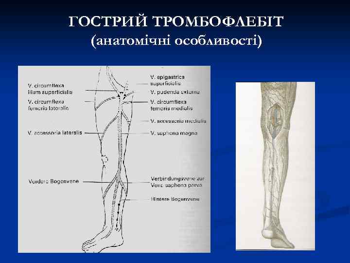 ГОСТРИЙ ТРОМБОФЛЕБІТ (анатомічні особливості) 