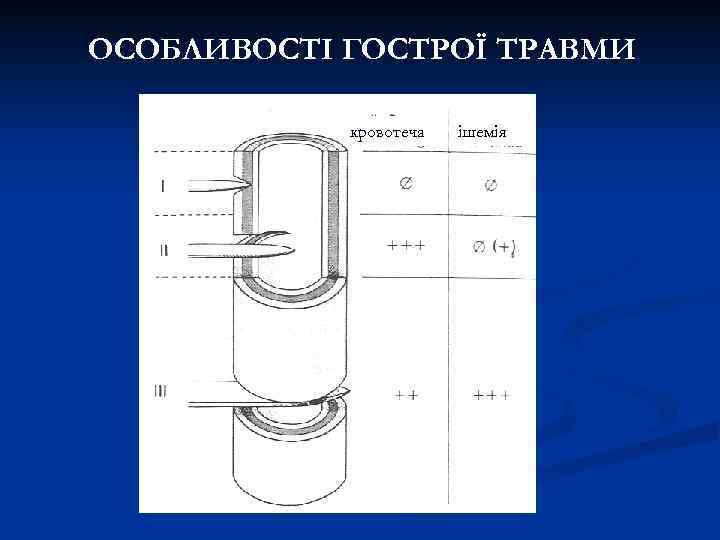 ОСОБЛИВОСТІ ГОСТРОЇ ТРАВМИ кровотеча ішемія 