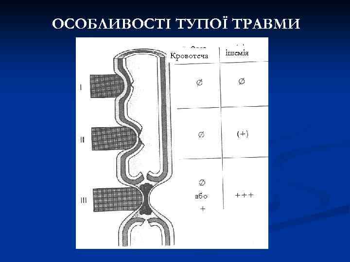 ОСОБЛИВОСТІ ТУПОЇ ТРАВМИ Кровотеча або ішемія 